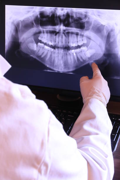Best Chipped Tooth Repair Near Me  in Thomson, GA